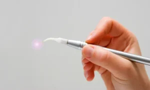 Laser Dentistry: A Gentler Way to Treat Cavities and Gums in Reno, NV